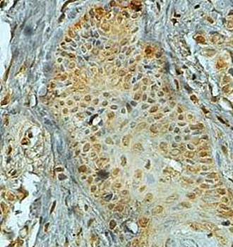 STAT1 Rabbit Polyclonal Antibody