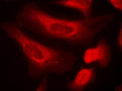 STAT1 (Phospho-Ser727) Antibody