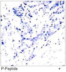 STAT1 (Phospho-Tyr701) Antibody