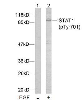 STAT1 (Phospho-Tyr701) Antibody