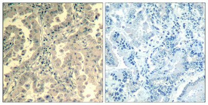 STAT2 (Ab-690) Antibody