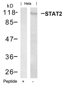 STAT2 (Ab-690) Antibody