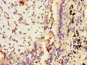 STAT2 Antibody