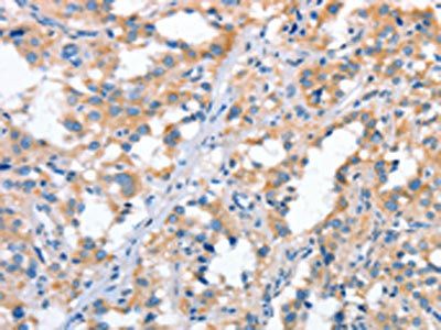 STAT2 Antibody
