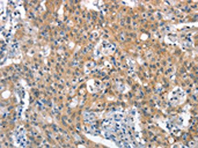 STAT2 Antibody