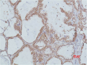 STAT2 Antibody