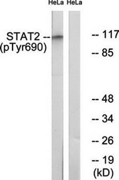 STAT2 (Phospho-Tyr690) Antibody