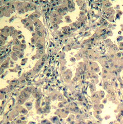 STAT2 (Ab-690) Antibody
