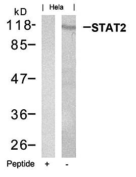 STAT2 (Ab-690) Antibody