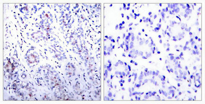 STAT3 Antibody