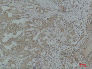 STAT3 Antibody