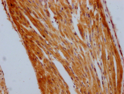 STAT3 Recombinant Monoclonal Antibody