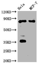 STAT3 Recombinant Monoclonal Antibody
