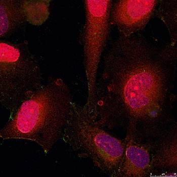 STAT3 (Ab-705) Antibody