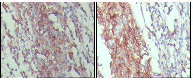 STAT3 Antibody