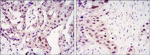 STAT3 Antibody