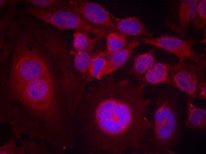 STAT3 (Phospho-Ser727) Antibody