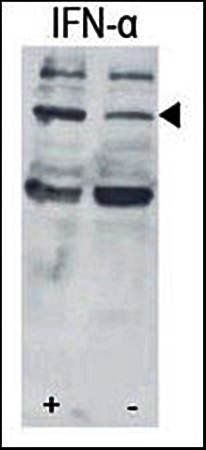 STAT3 (phospho-Ser727) antibody