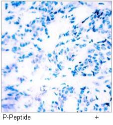 STAT3 (Phospho-Tyr705) Antibody