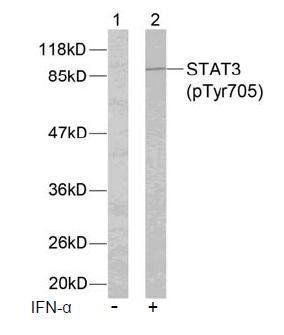 STAT3 (Phospho-Tyr705) Antibody