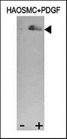 STAT3 (phospho-Tyr705) antibody