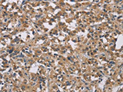 STAT4 Antibody