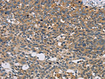 STAT4 Antibody