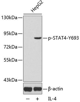 STAT4 (Phospho-Y693) antibody