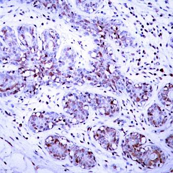 STAT4 Rabbit Polyclonal Antibody