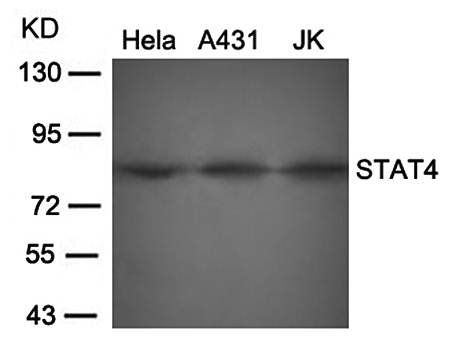 STAT4 Rabbit Polyclonal Antibody