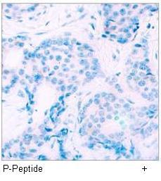 STAT4 (Phospho-Tyr693) Antibody