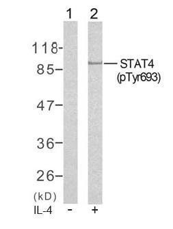 STAT4 (Phospho-Tyr693) Antibody