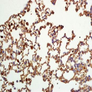 STAT5a (phospho-Tyr694) antibody