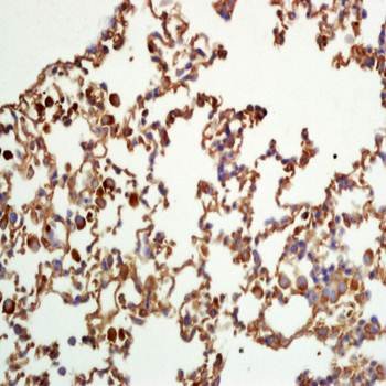 Phospho-STAT5a (Tyr694) Rabbit Polyclonal Antibody