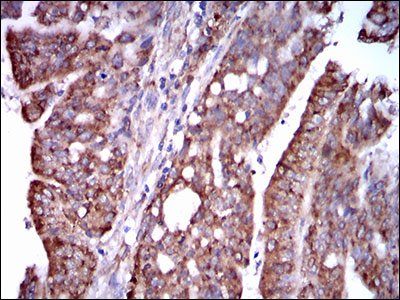 STAT5A Antibody