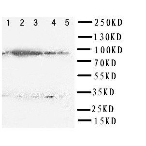 STAT5a Rabbit Polyclonal Antibody