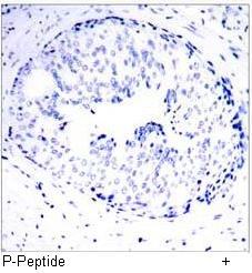 STAT5A (Phospho-Ser780) Antibody
