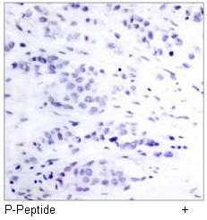 STAT5A (Phospho-Tyr694) Antibody