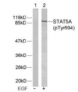 STAT5A (Phospho-Tyr694) Antibody