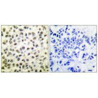 STAT5B Antibody