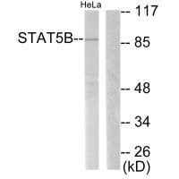STAT5B Antibody