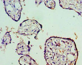STAT5B Antibody