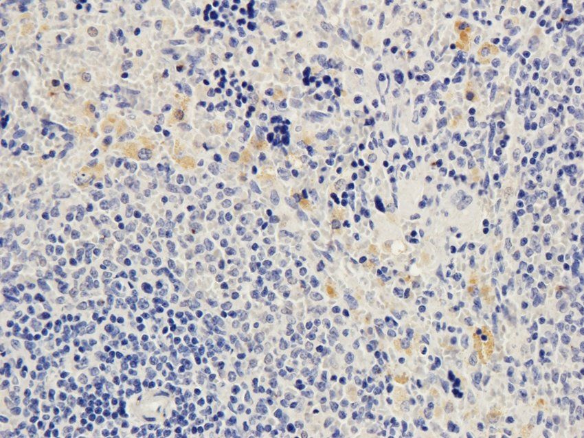 STAT5B antibody