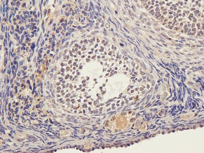 STAT5B antibody