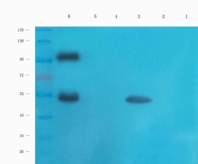 STAT5B antibody