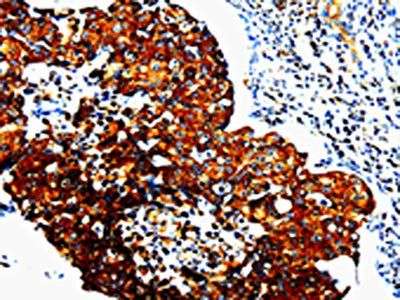 STAT5B Antibody