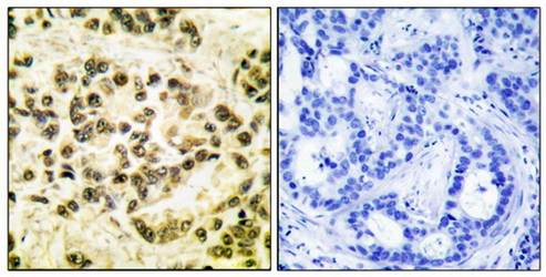 STAT5B (phospho-Ser731) antibody