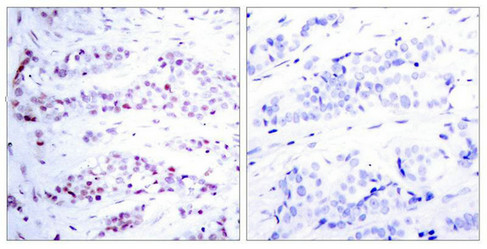 STAT6 (Ab-641) Antibody
