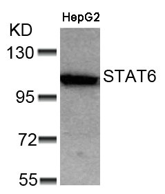 STAT6 (Ab-641) Antibody