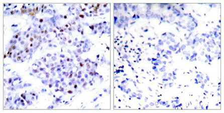 STAT6 (Ab-645) Antibody